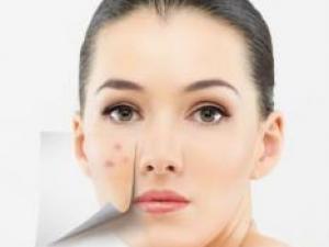 Ę���L������ʲôԭ����Ę���L������ô�{(di��o)�����ഺ����ô����