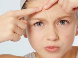 臉上長痘痘怎么調理？臉上長痘痘切忌不能做五件事