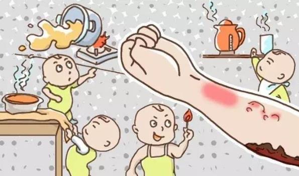 手被開水燙傷了怎么辦 該如何急救
