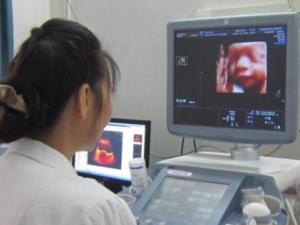 做四維彩超需要做什么準(zhǔn)備?哪些畸形情況思維彩超查不出?