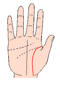 生命線圖解:生命線之弧形少