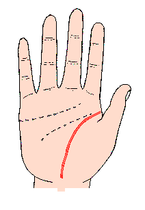 生命線圖解:生命線成為鏈狀