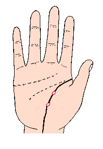 生命線的中途,出現島形記號