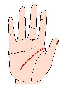 智慧線圖解：頭腦線成為鏈狀
