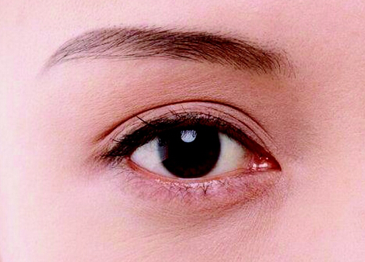 怎樣讓眼睛自然變大？什么是小眼癥矯正