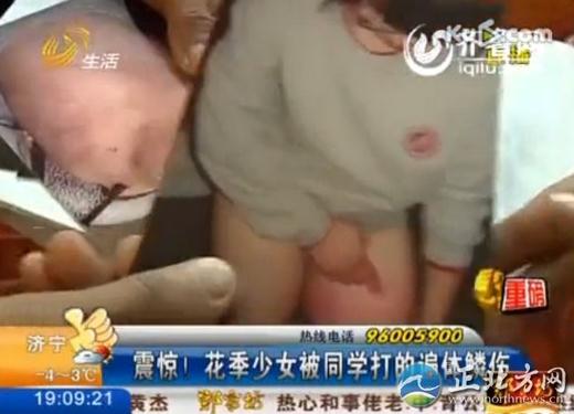 16歲花季少女被四名室友毆打4小時，脫光了跪在地上打，打得遍體鱗傷