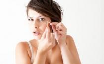 這些祛痘的治療偏方你知道嗎？