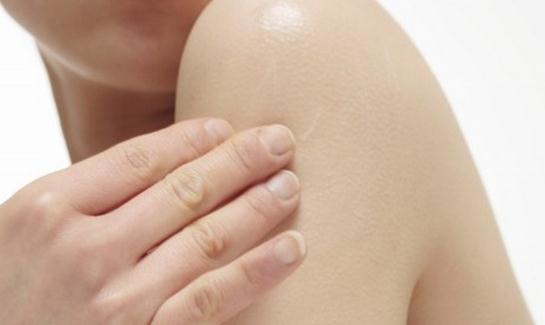 秋季皮膚干燥？拒絕干燥做個水女人！