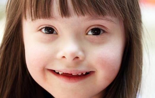 你了解唐氏癥嗎？ 唐氏癥有哪些癥狀？