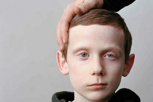 注重6個細節幫助你遠離面癱