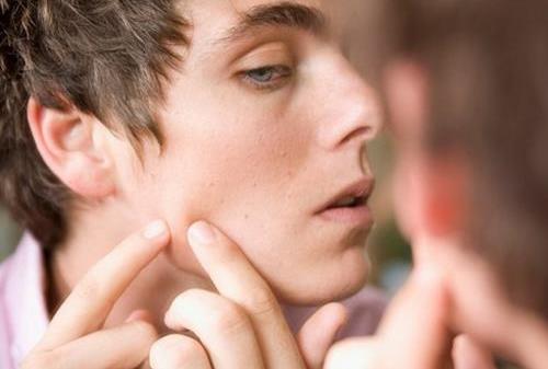 男人臉上長痘怎么辦 推薦三個祛痘方法