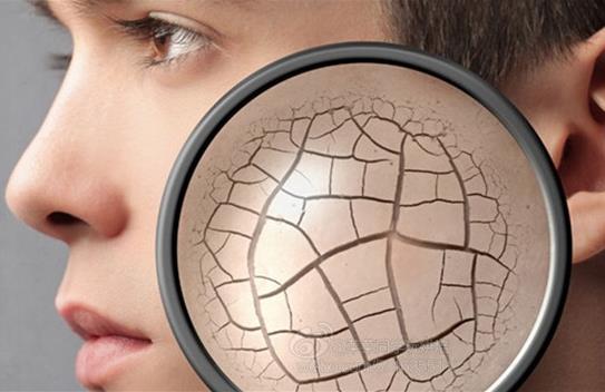 冬天皮膚干燥起皮的原因及緩解方法 冬季美容護膚食物