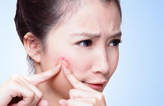 臉長(zhǎng)痘痘遲遲不消 小心粉瘤來襲