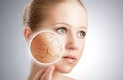 冬季=皮膚干燥瘙癢保養方法 皮膚干燥常吃3種蔬菜