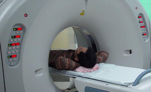 有人對于CT檢查是談及色變 CT檢查不一定會致癌