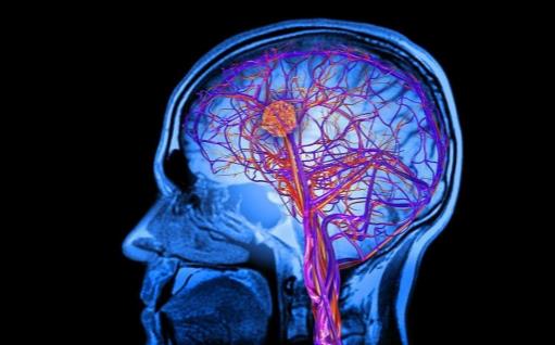 早上起床時，體外出現四個特征，很遺憾，腦出血可能已經找上你 