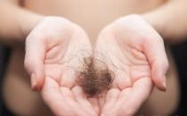 讓脫發嚴重的年輕人頭發濃密的方法 脫發食療方推薦