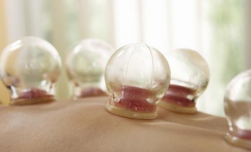 拔火罐并非人人適合 有的人拔火罐等于在自殘