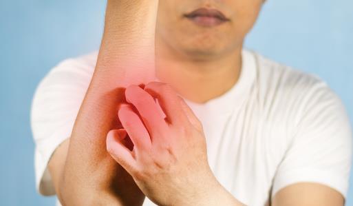 臉過敏發(fā)紅了怎么辦?