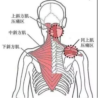 湛江崇愛康復醫院科普如何防治肌筋膜炎 以真誠來服務患者