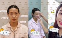 自體多肽脂肪實現新突破，塑造無法復制的自然美