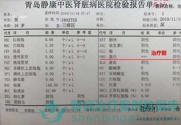 腎病綜合征小患者青島靜康中醫腎病醫院治療后病情改善