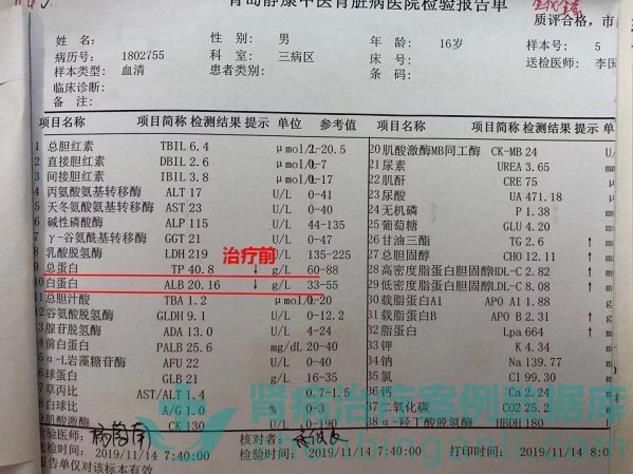 腎病綜合征小患者青島靜康中醫腎病醫院治療后病情改善