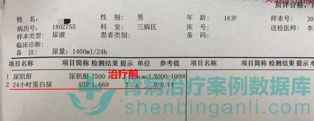 腎病綜合征小患者青島靜康中醫腎病醫院治療后病情改善