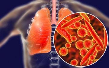 【新型冠狀病毒肺炎】新冠病毒感染肺炎早期癥狀、潛伏期、預(yù)防、治療