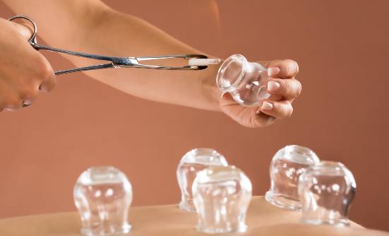 拔火罐減肥能減肥嗎 拔火罐減肥有哪些注意事項