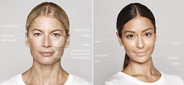 常州曙光美容醫院做眼部整形怎么樣 安全自然定制美麗