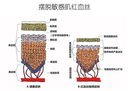 放心！有美薏升修復敏感肌紅血絲專家產品在，你每天都可以美美噠