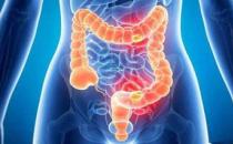 昆明東大肛腸醫院提醒：腸癌高發這六類人腸鏡檢查費用一定不能省