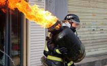 肚臍下面疼是怎么回事，肚臍下面疼是怎么回事男性