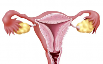 乳腺結節一定要切除嗎 需要及時手術治療的情況